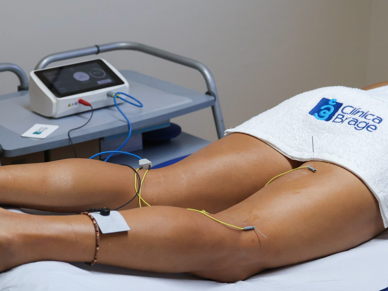 Tratamiento de neuromodulación ecoguiada en Clínica Brage, Ferrol
